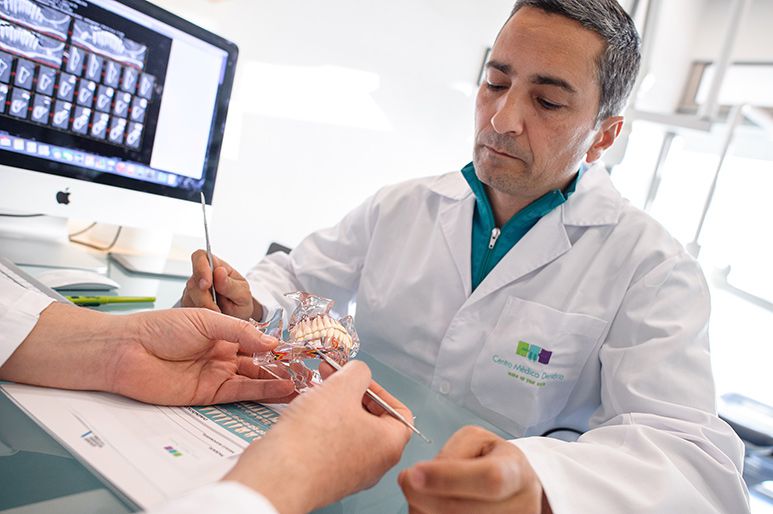 Implantes Dentários